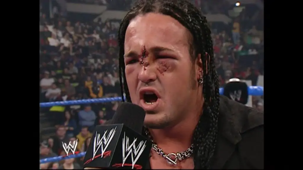 Joey Mercury's Broken Nose